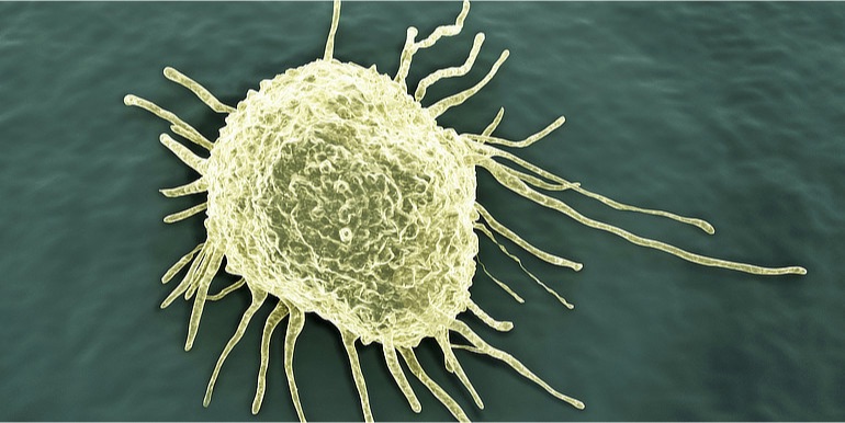 Vědci vypátrali příčinu rezistence rakoviny tlustého střeva vůči cílené léčbě