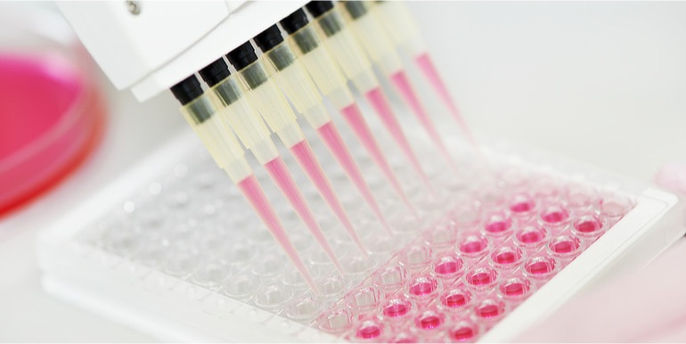 Breast cancer gene provides vital clue to bowel cancer drug resistance